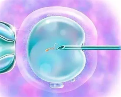 上海国妇婴男性孕前检查怎么取精？取精室vs家庭取精全攻略